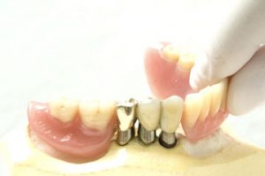 38015763