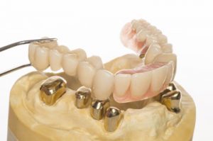 50168170