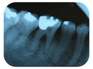 Fotolia_168099007